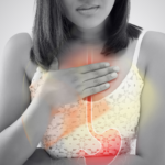 Best yoga for acidity reflux and Heartburn from stomach acid